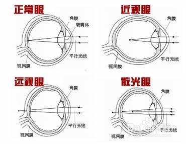 如何選擇（網上，實體店）合格的眼鏡？