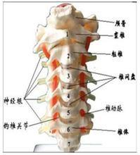 如何判斷頸椎病的類型？