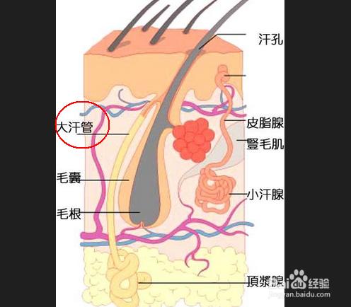 狐臭產生的原因，有了狐臭該如何治療？