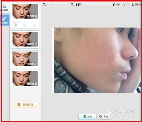 美圖秀秀教程：[1]祛痘