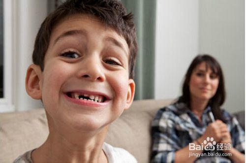 兒童換牙預防齲齒以及其他的注意事項