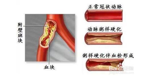 吃海帶有哪些好處？