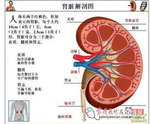 腎結石的早期症狀