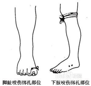 被蛇咬了怎麼辦？ 自救小知識