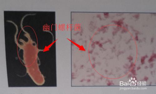 有口臭怎麼辦？