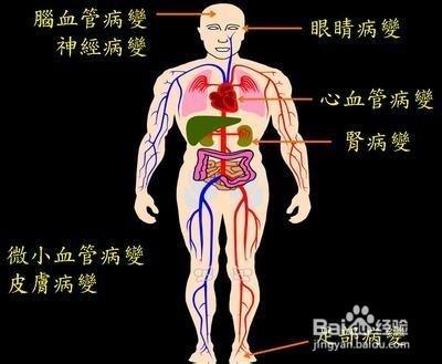 糖尿病的食補祕方