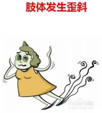 腦血栓的危險前兆