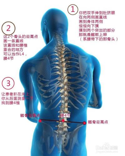 雙踣教你腰椎間盤突出布貼膏藥的正確貼法和位置