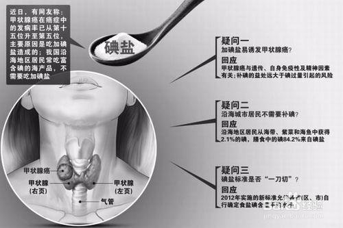 說說甲狀腺癌