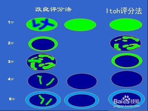 超聲診斷中彈性成像操作要點及注意事項