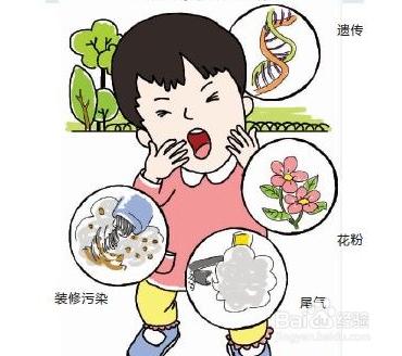 過敏性鼻炎怎麼治 過敏性鼻炎治療方法分享