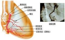 心血管疾病的症狀