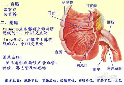 如何識別闌尾炎