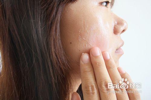 皮膚過敏：貝.母舒敏.膏的正確使用方法
