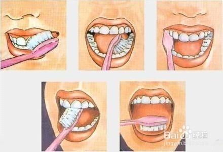 總是牙齦出血怎麼辦?