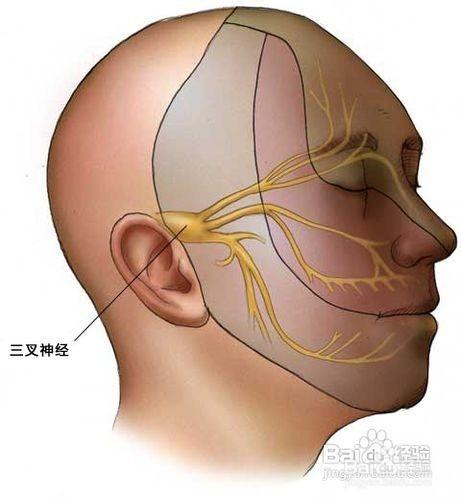 三叉神經痛：[2]陽明熱盛型的針刺療法