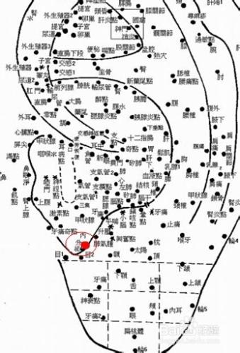 肥胖且食慾旺盛者的治療方法