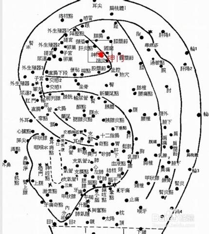 肥胖且食慾旺盛者的治療方法