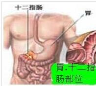 胃、十二指腸球部潰瘍注意事項