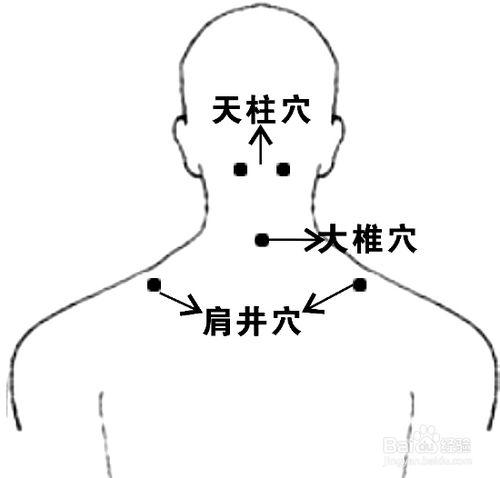 頸椎病治療方法