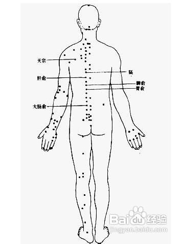 重度褥瘡的治療方法