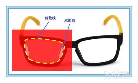 弱視治療方法