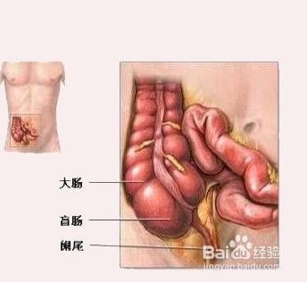 疾病信號——如何判斷腹痛是什麼病