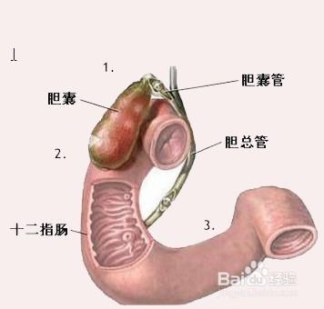 疾病信號——如何判斷腹痛是什麼病