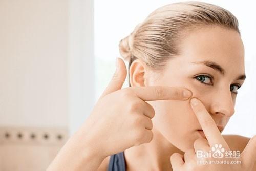 紅黴素眼藥膏能治療青春痘。