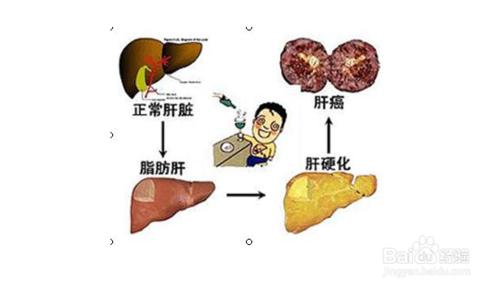 血脂高的危害