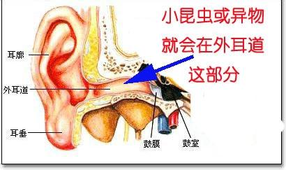 小孩兒中進入異物要如何處理呢進入昆蟲如何處理