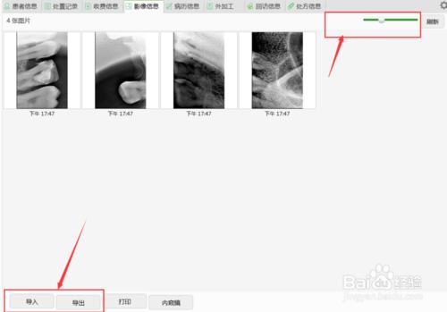 牙醫管家影像信息操作方法