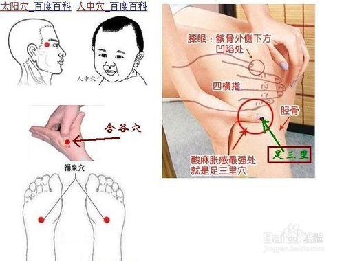 冬季煤氣或一氧化碳中毒怎麼辦自己怎麼處理