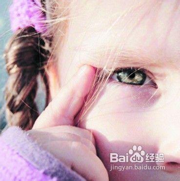 兒童八種情況可能患眼病