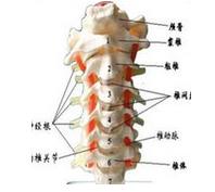 怎樣治療頸椎病？需要開刀嗎?