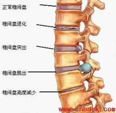 緩解頸椎疼痛小方法