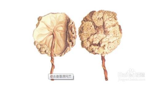 內分泌失調的原因和調節方法