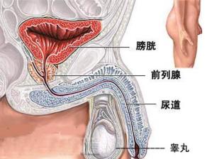 膀胱癌的病因和治療