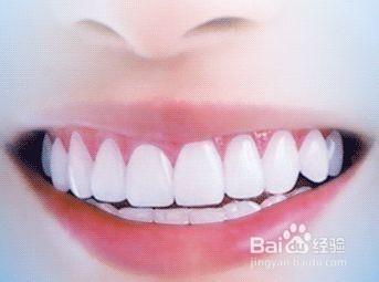 說說牙齒美白的小竅門