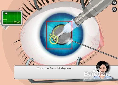 眼科手術小遊戲攻略