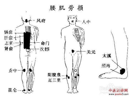 腰肌勞損怎麼最好的恢復方法？腰痛復正貼黑膏藥