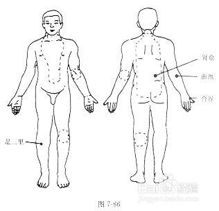 類風溼關節炎的砭石療法~老中醫推薦