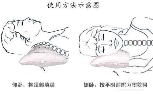 枕頭高低引起的頸椎問題