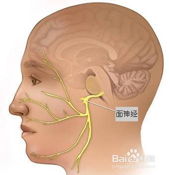 面肌痙攣患者治療中血管減壓術治療需要注意什麼