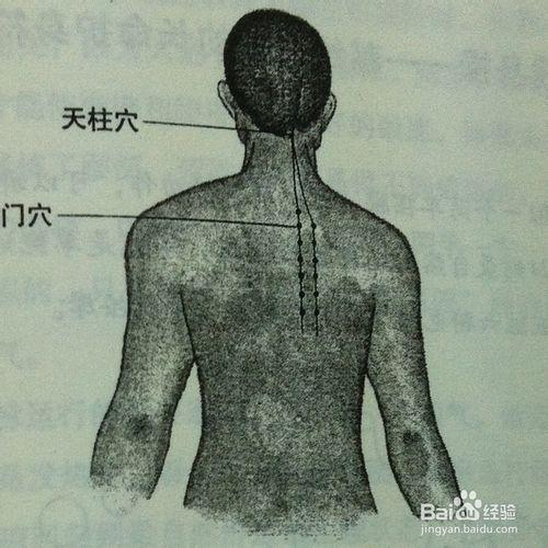中醫治療肩周炎 頸椎病的方法