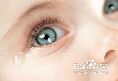 新生兒常見眼科疾病