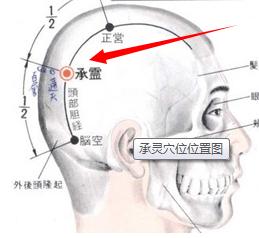 承靈穴穴位位置圖及作用