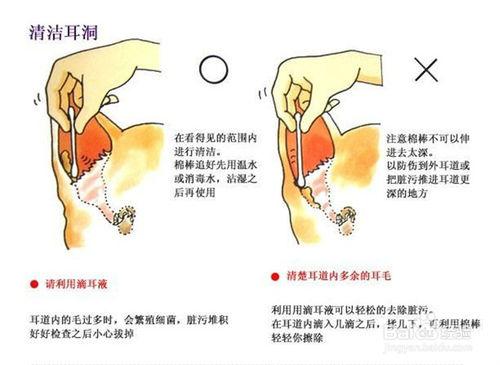 怎麼給寶寶清理耳垢，呵護寶寶聽力