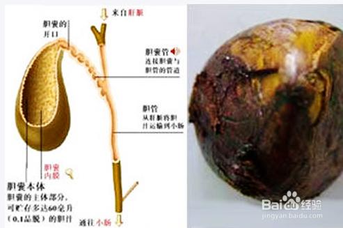 減肥引發8大疾患危機