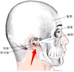 聽會穴穴位位置圖及作用